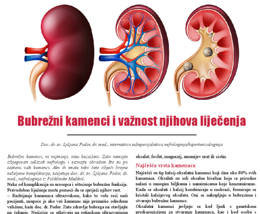 Bubrežni kamenci i važnost njihova liječenja