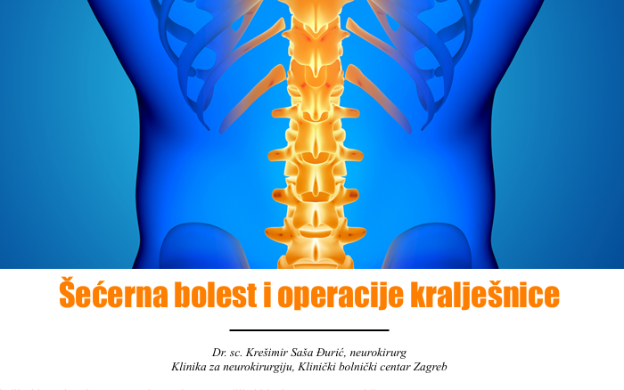 Šećerna bolest i operacije kralješnice